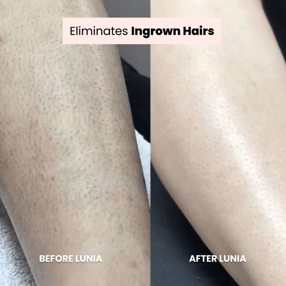 Megical Unisex 2 in 1 Electric Shaver