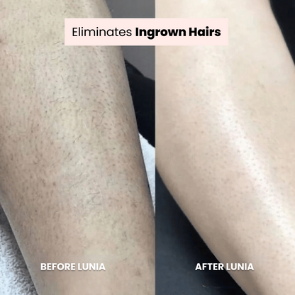 Megical Unisex 2 in 1 Electric Shaver